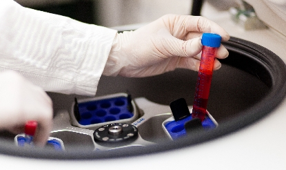 Understanding centrifugation Understanding centrifugation